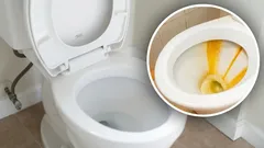Rokmi usadený povlak v toalete zmizol: pomohla domáca zmes z troch látok